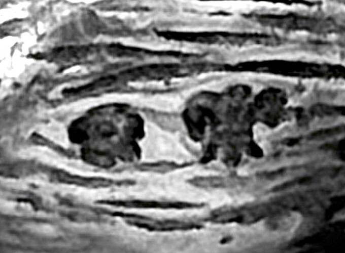 8b1fcf37040578121f47bca03b2804121ebae9b7